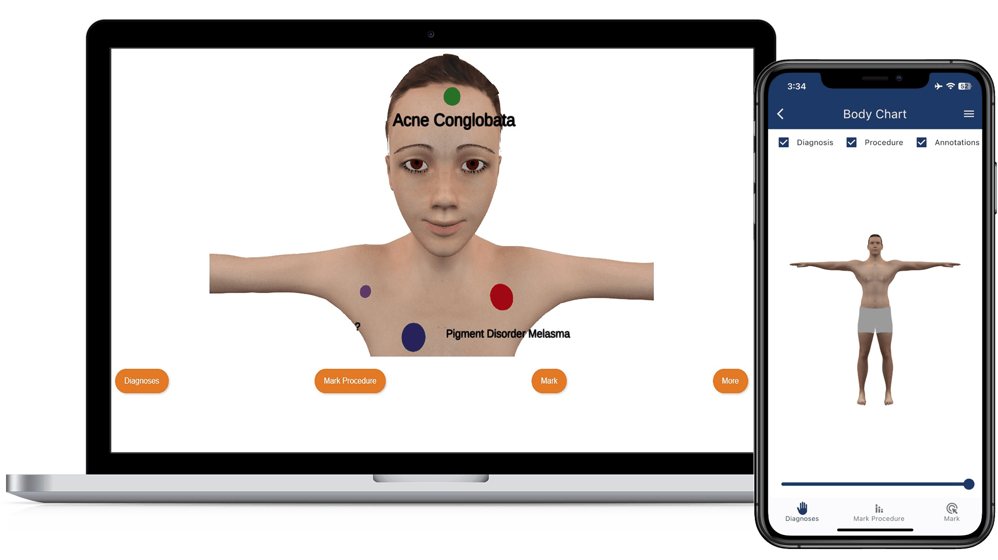 Body Chart
