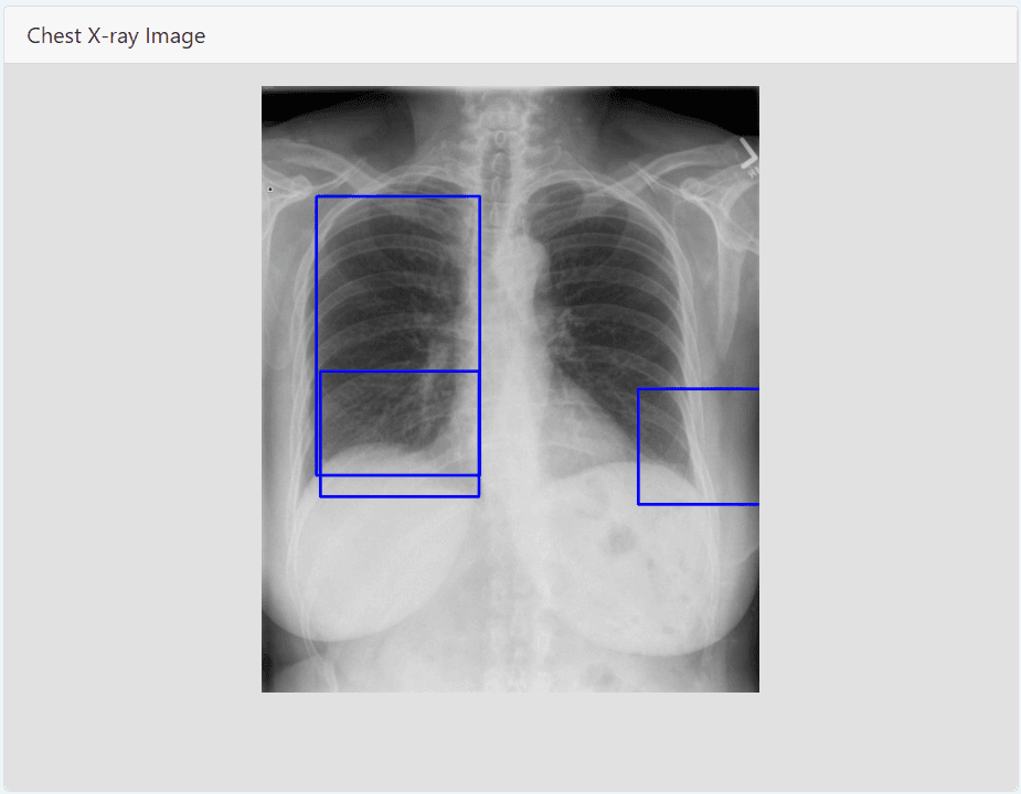 Opacity Detection