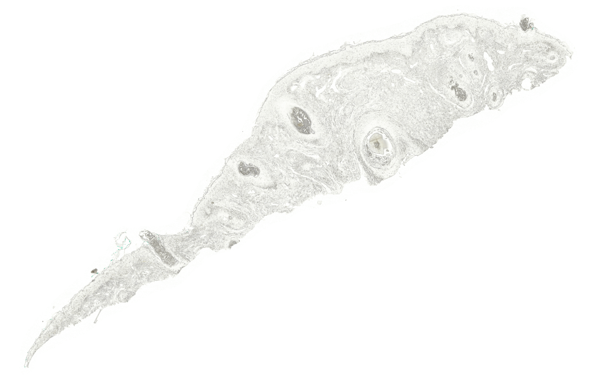 Accelerating Skin Diagnosis