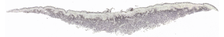 Accurate Analysis of Fungal Presence