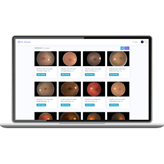 Optha Insights